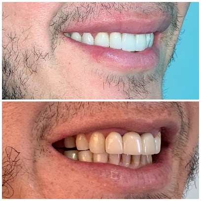 Implante Dental Santiago Centro