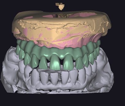 Laboratorio Dental Milan